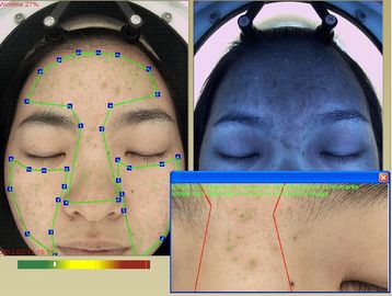 Cosmetics Using 3D Wrinkle Analysis Machine RGB + UV + PL 3 Spectrums