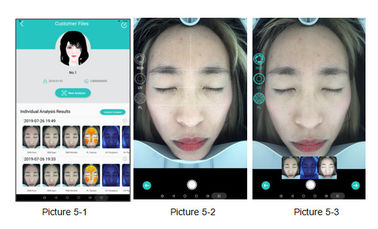 Professional Wrinkle Analysis Software Supporting For Automatic Precise Analysis