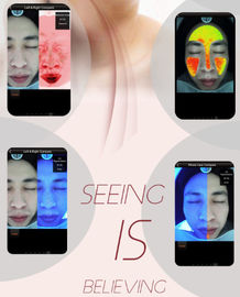 Professional Skin Analysis Equipment OEM &amp; ODM Service With 1 Year Warranty