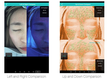 Doctor Use 3D Face Home Analyzers With 30 Million Clinical Databases