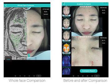 Doctor Use 3D Face Home Analyzers With 30 Million Clinical Databases