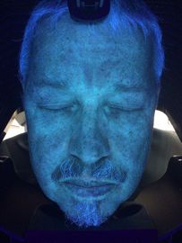 15 Seconds Highly Efficient Home Analyzers For Skin Pigment Moisture