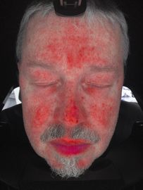 Facial Skin Scanner Analysis , Skin Analyzer Machine With Ce Certificate