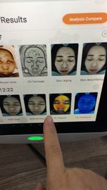 Therapist Smart Skin Analyzer Detect Deep Skin Problem  Ce Certificate