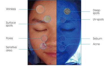 45W Power Smart Skin Analyzer Machine PDF Print for Doctor Beauty Salon