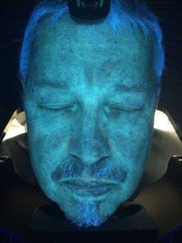 Skin Detection Equipment Therapist Dermis Layer Detect 10 Years Experience