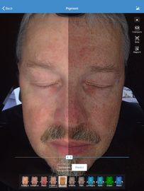 Facial 3d Skin Analyzer Scanner Visia 32gb Storage For Doctor Skin Clinic