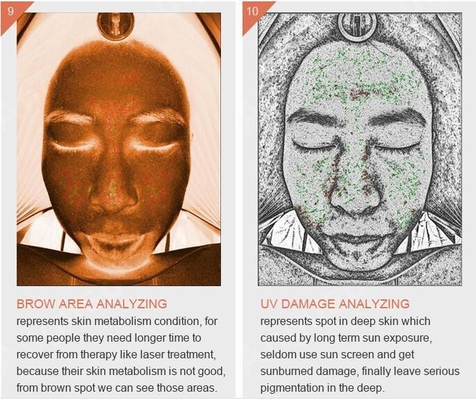 Woods Lamp UV RGB Professional Skin Analysis Machine For Skin Care