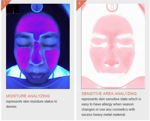 Skincare Wrinkle Pigmentation Acne Skin Analyser Machine 3D Smart Quizzes