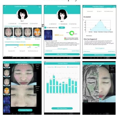 Professional Skin Hydration Analyzer Facial Camera 10.4 inch Screen 20MP