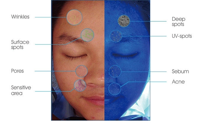 45W Power Smart Skin Analyzer Machine PDF Print for Doctor Beauty Salon