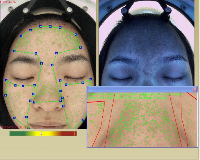 UV RGB 3d Facial Skin Analyzer Device Face Analyzer Machine
